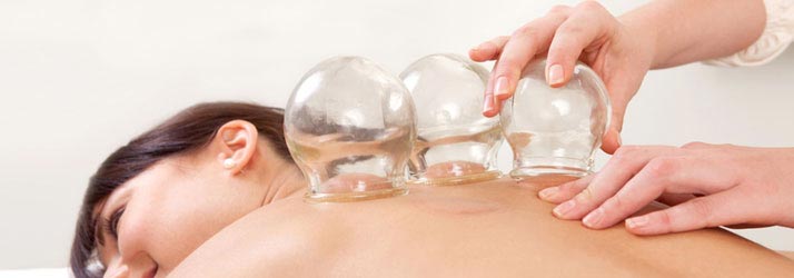 Chiropractic San Francisco CA Cupping